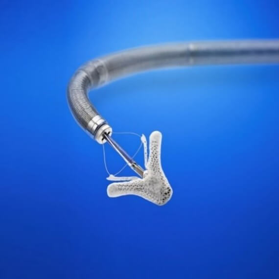 MitraClip