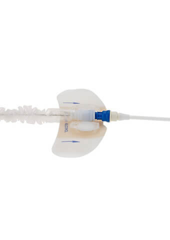 Heart Failure Portfolio Image